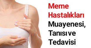 meme hastalıkları tedavisi