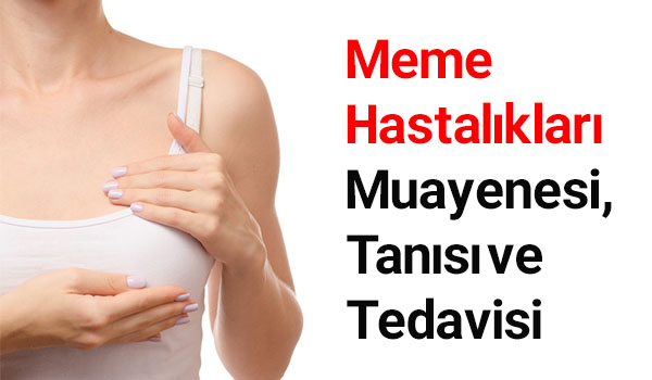 meme hastalıkları tedavisi